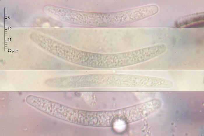 macrostoma