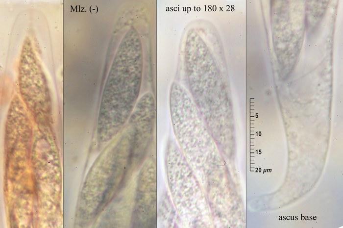 macrostoma
