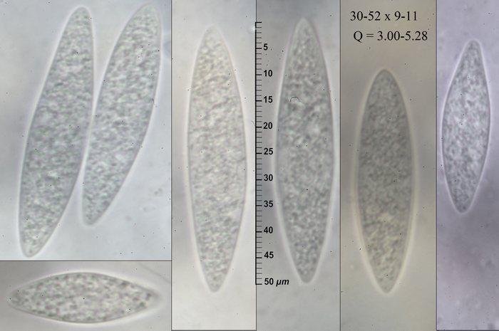 macrostoma
