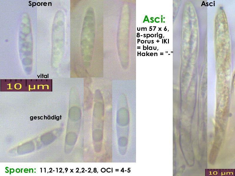 macrostoma