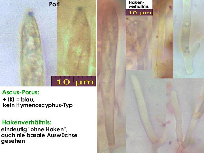 macrostoma
