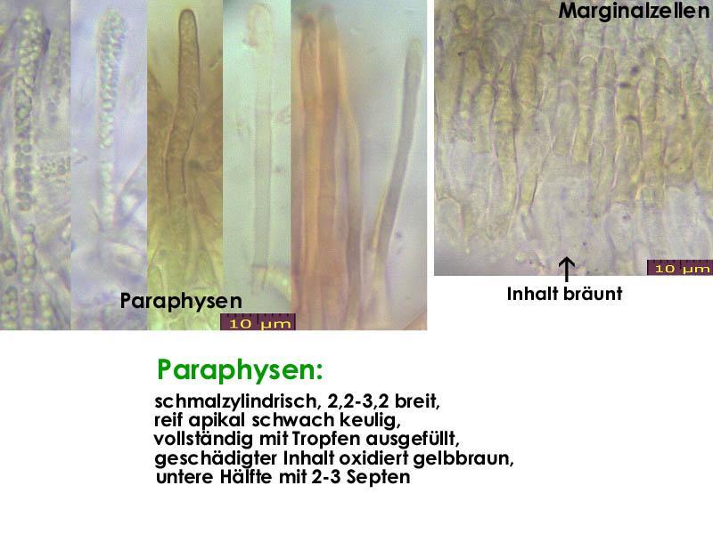 macrostoma