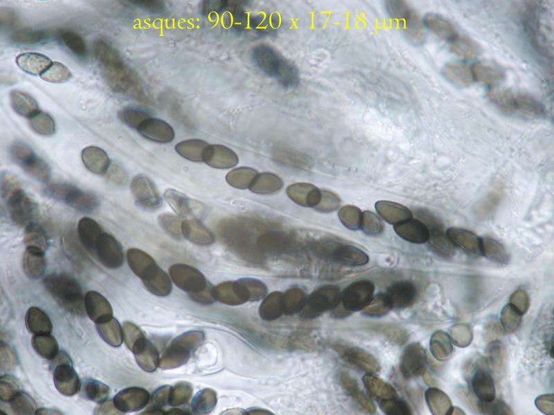 macrostoma