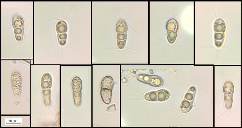 macrostoma