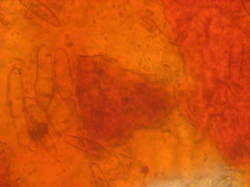macrostoma