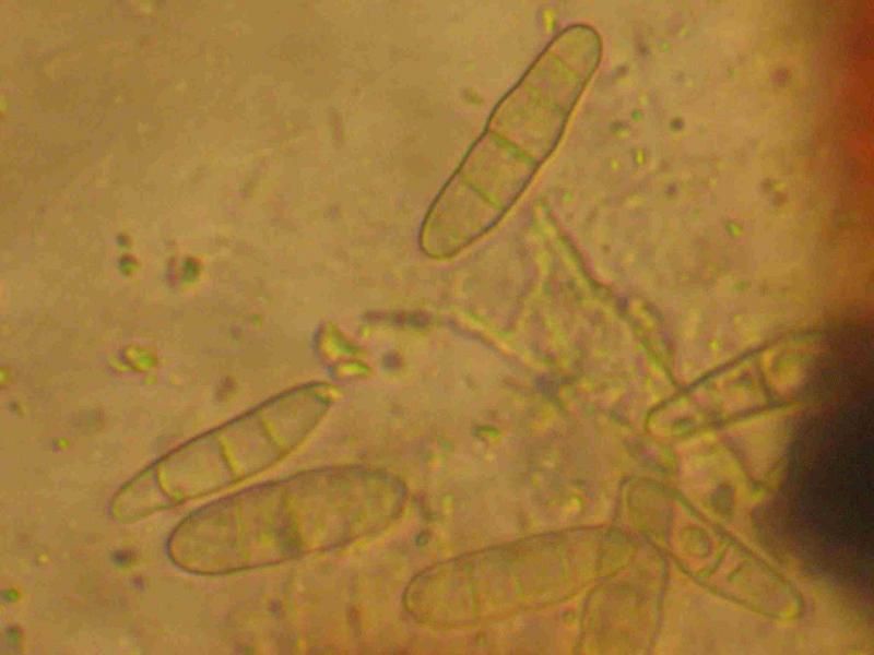 macrostoma