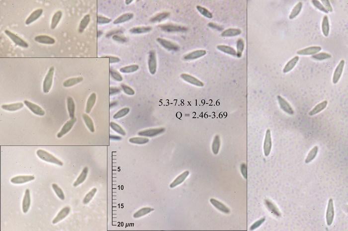 macrostoma