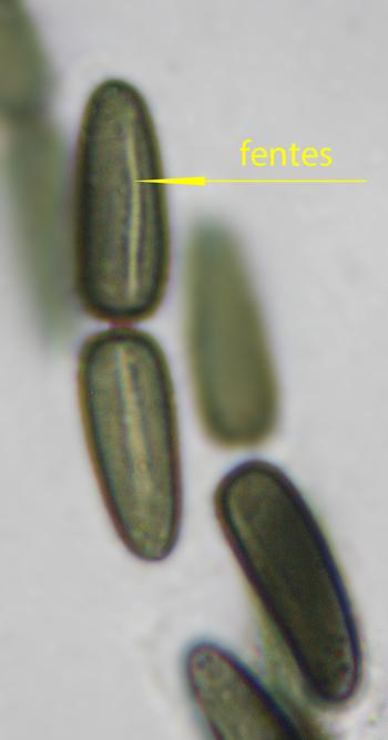 macrostoma