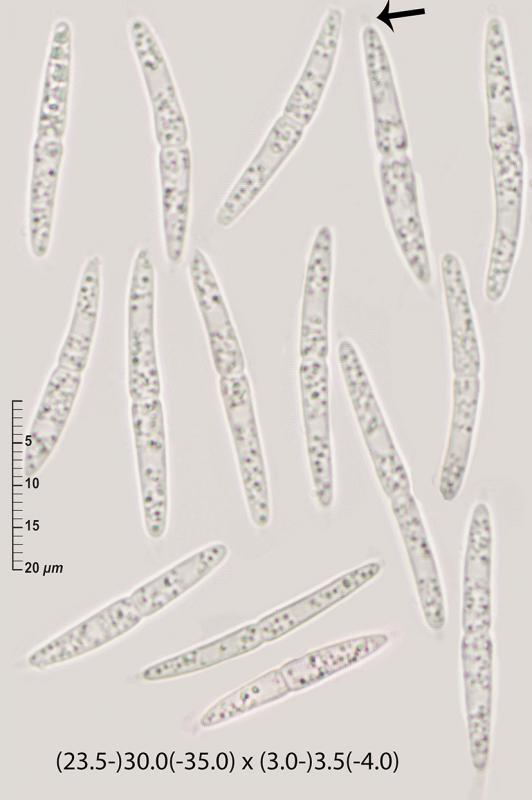 macrostoma