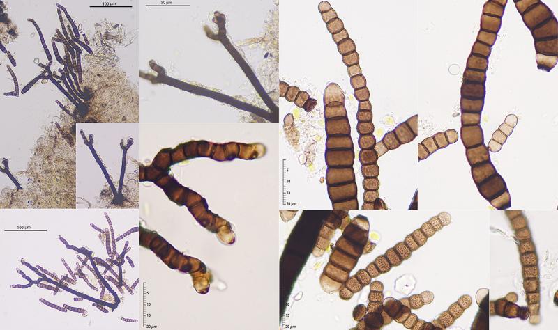 macrostoma