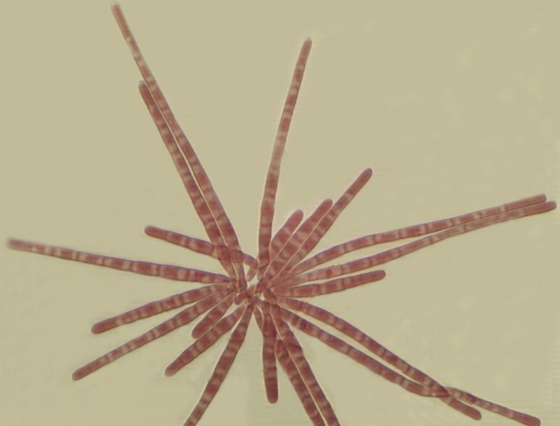 macrostoma
