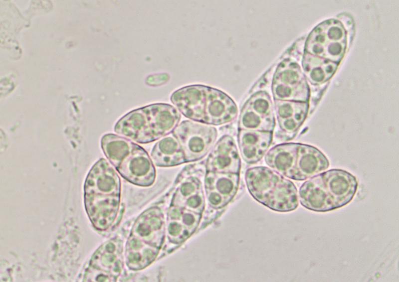macrostoma