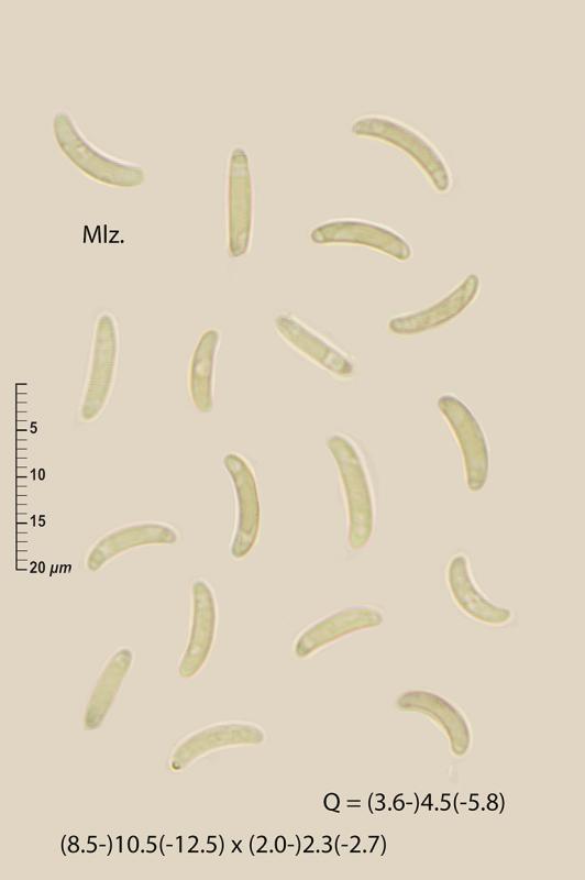 macrostoma