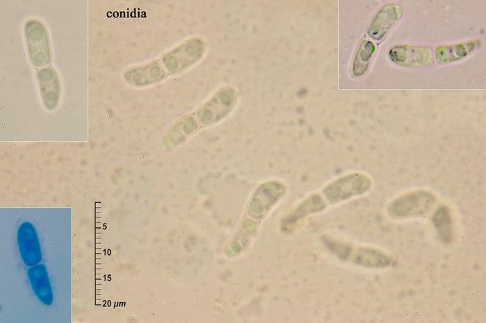 macrostoma