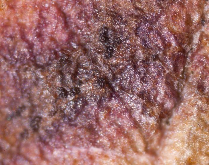 macrostoma