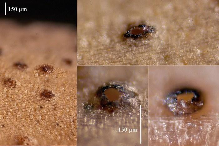 macrostoma