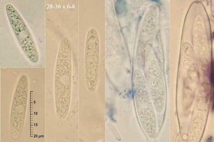 macrostoma
