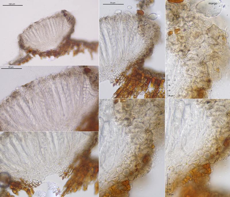 macrostoma