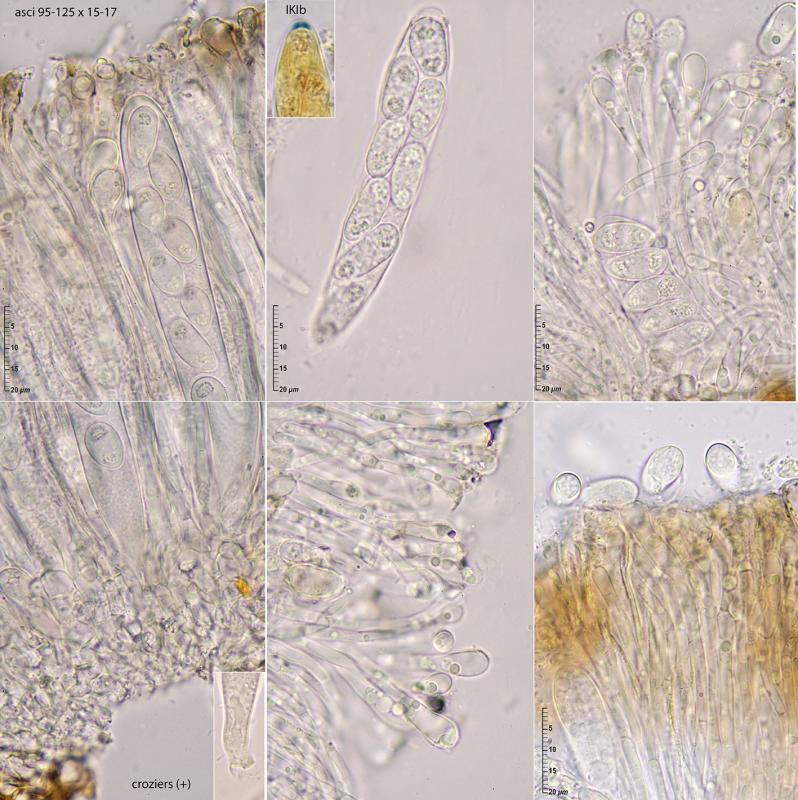 macrostoma