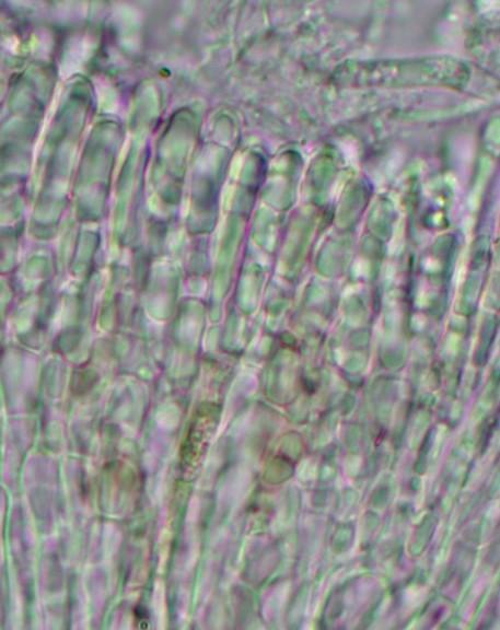 macrostoma
