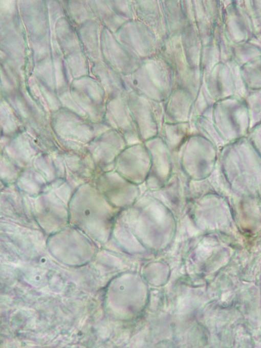 macrostoma
