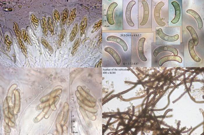 macrostoma
