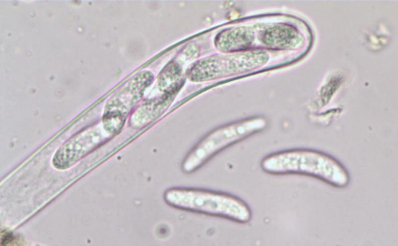 macrostoma
