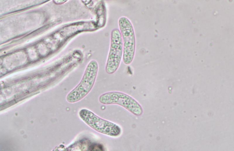 macrostoma