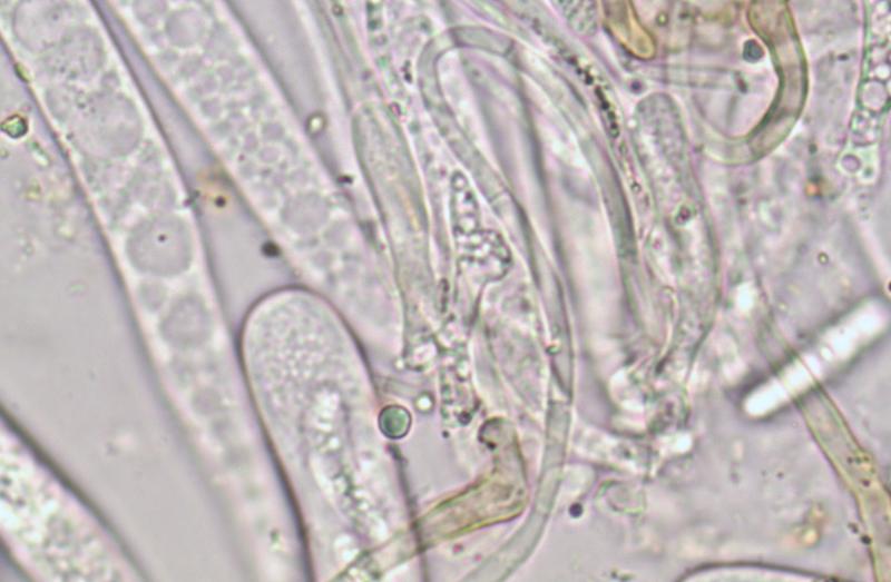 macrostoma