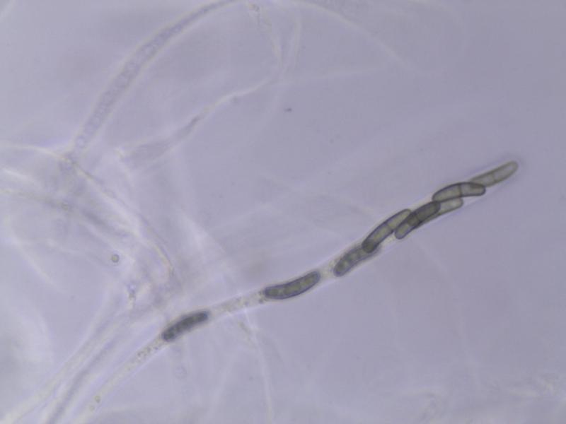 macrostoma