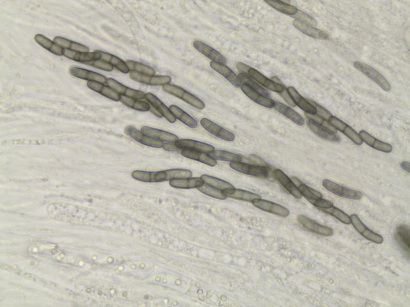 macrostoma
