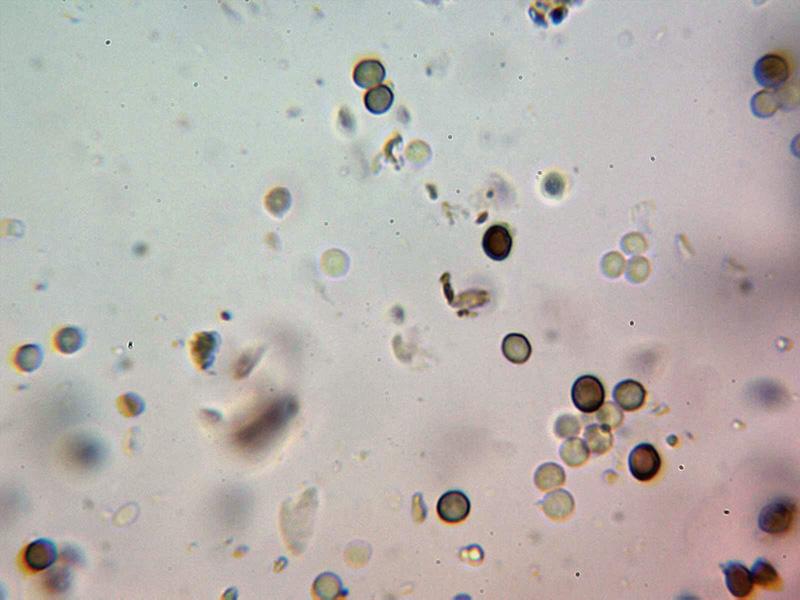 macrostoma