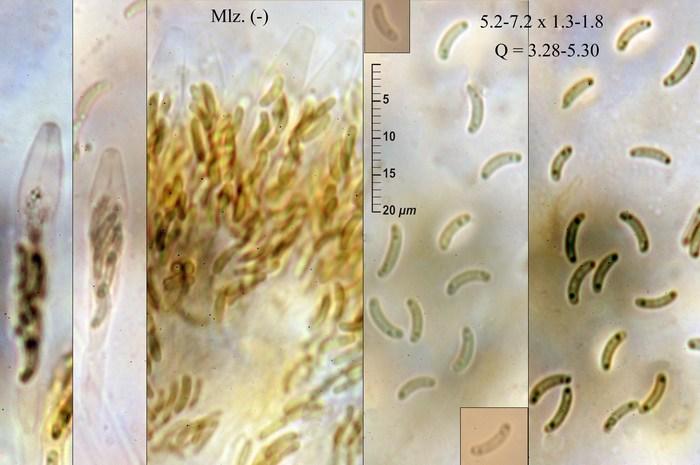 macrostoma