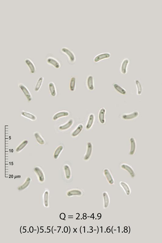 macrostoma