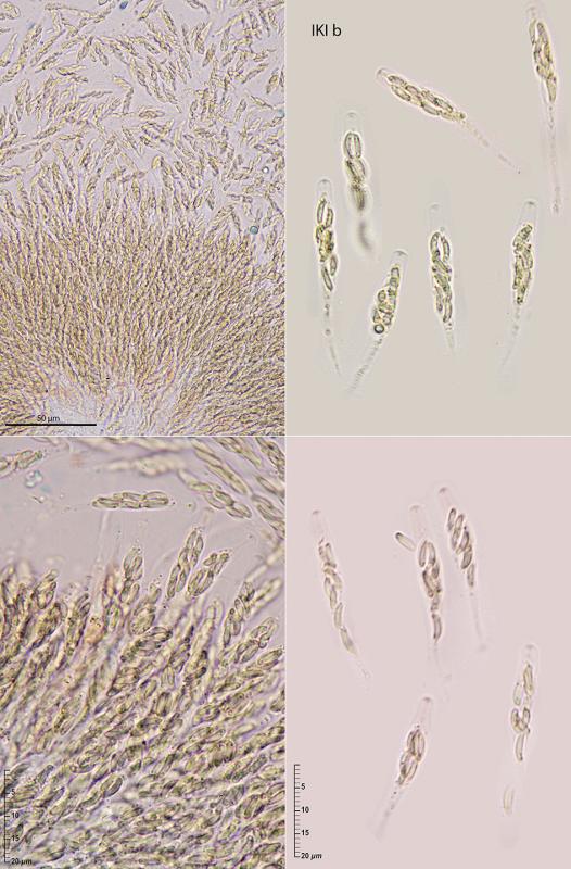 macrostoma