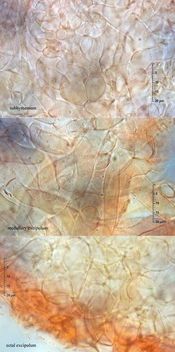 macrostoma