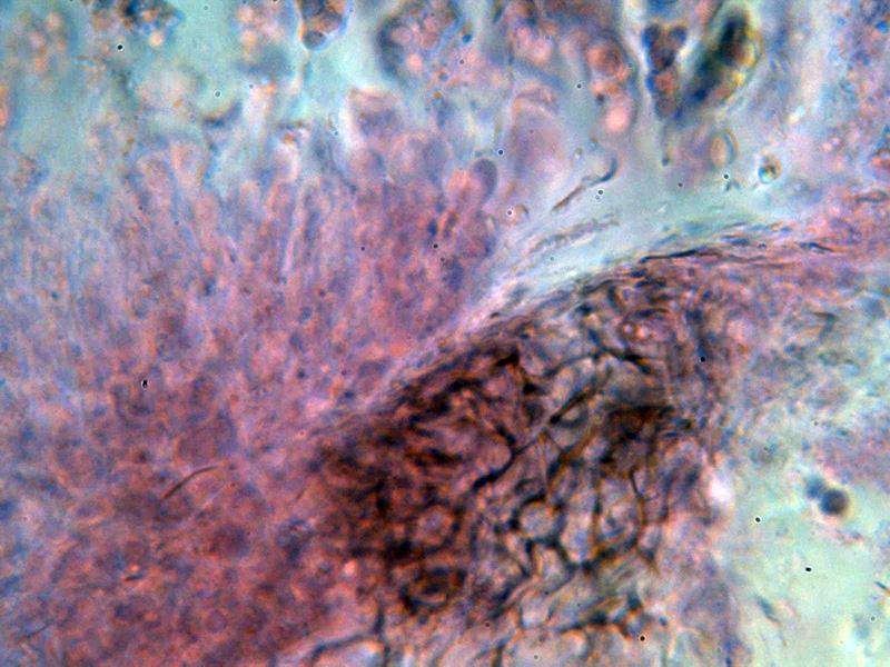 macrostoma