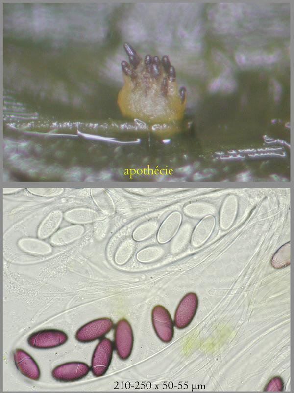 macrostoma