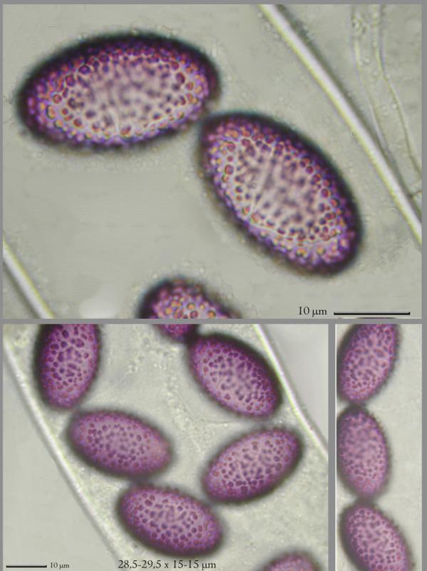 macrostoma