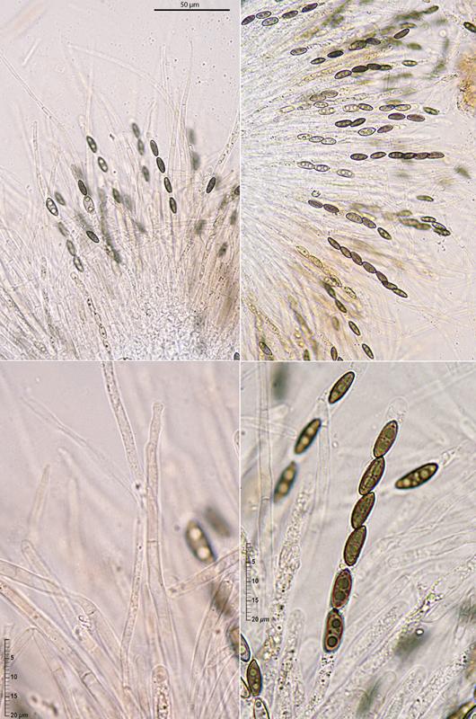 macrostoma