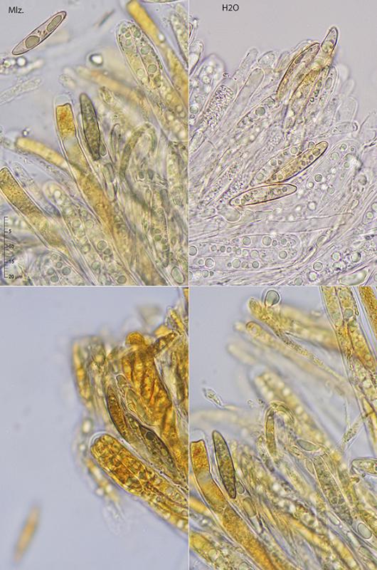 macrostoma