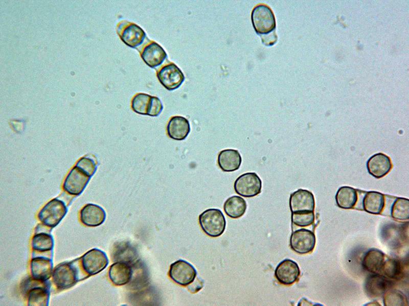 macrostoma