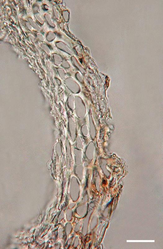 macrostoma