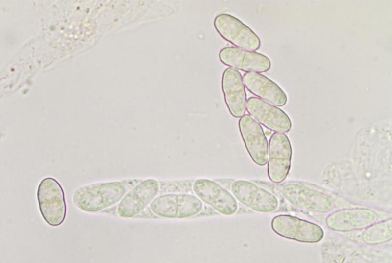 macrostoma