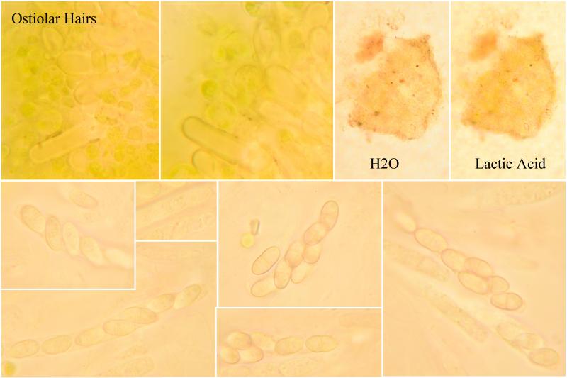 macrostoma