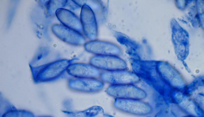 macrostoma