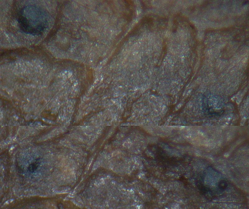 macrostoma