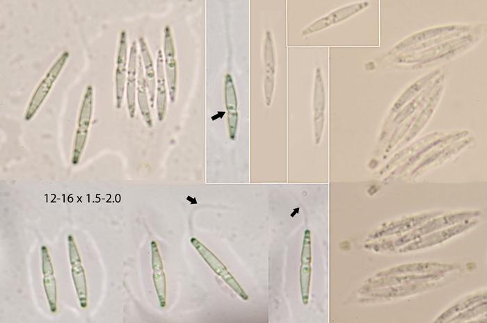 macrostoma