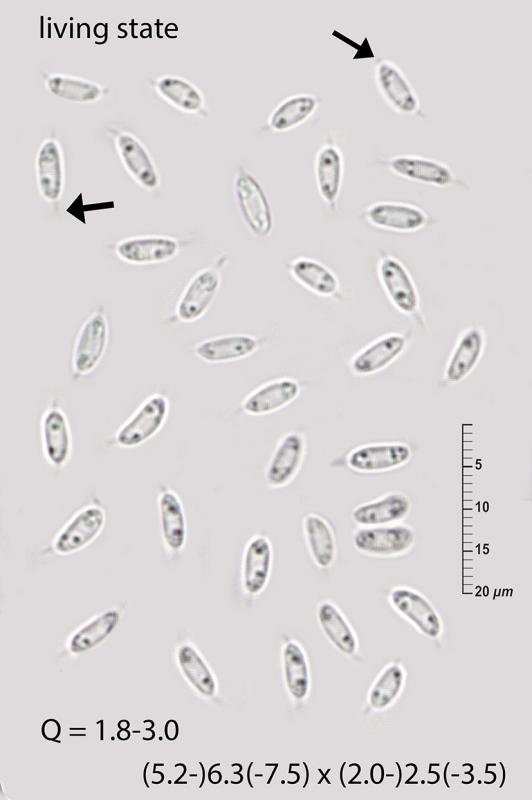 macrostoma