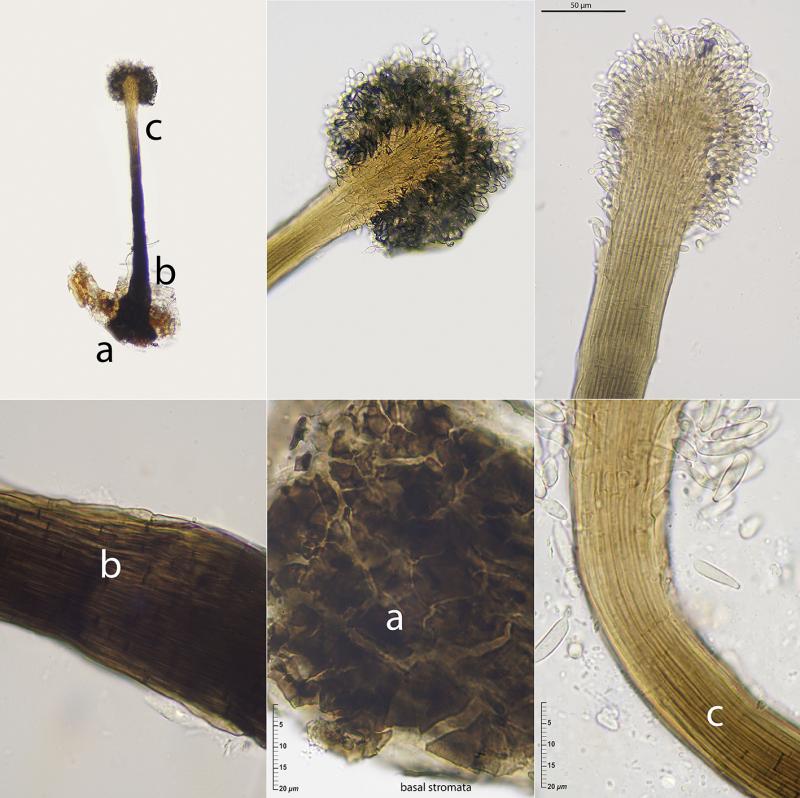 macrostoma